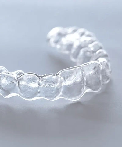 Капи Інвізілайн (Invisalign). Повний огляд